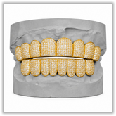 Custom Moissanite Diamond Grillz 14K Yellow Gold