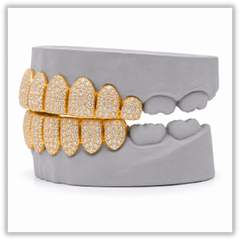 Custom Moissanite Diamond Grillz 14K Yellow Gold