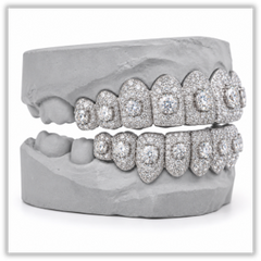 Moissanite Honeymoon Set Grillz DQ1057