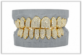 Full Bust Down VVS Moissanite Diamond Yellow Grillz (Copy)