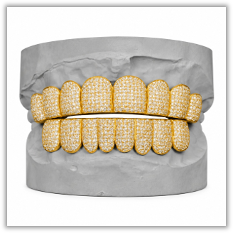 Custom Moissanite Diamond Grillz 14K Yellow Gold