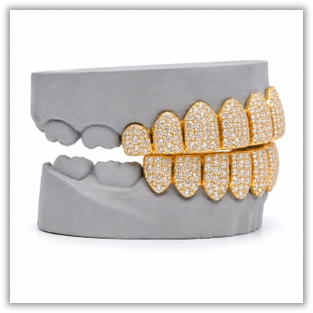 Custom Moissanite Diamond Grillz 14K Yellow Gold
