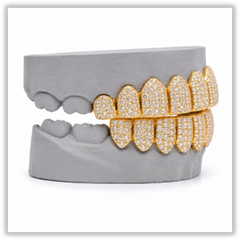 Custom Moissanite Diamond Grillz 14K Yellow Gold
