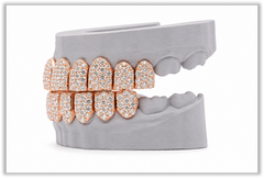 Jumbo (6 Pointer) VVS Moissanite Diamond Rose Grillz