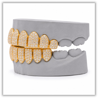 Custom Moissanite Diamond Grillz 14K Yellow Gold