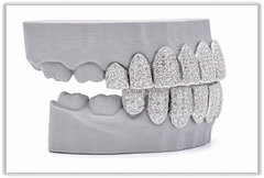 Jumbo (6 Pointer) VVS Moissanite Diamond White Grillz