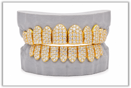 Jumbo (6 Pointer) VVS Moissanite Diamond Yellow Grillz