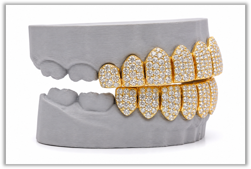 Jumbo (6 Pointer) VVS Moissanite Diamond Yellow Grillz