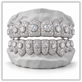 Moissanite Honeymoon Set Grillz DQ1057