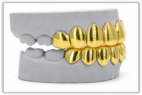 Custom Gold Solid Yellow Grillz