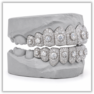 Moissanite Honeymoon Set Grillz DQ1057