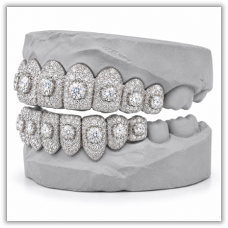 Moissanite Honeymoon Set Grillz DQ1057