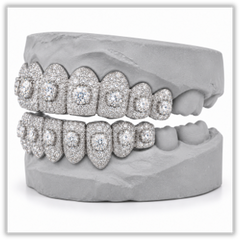 Moissanite Honeymoon Set Grillz DQ1057