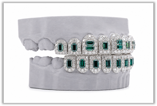 May Birthstone Green Emerald VVS Moissanite Diamond Grillz