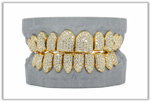 Full Bust Down VVS Moissanite Diamond Yellow Grillz