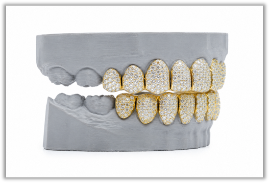 Full Bust Down VVS Moissanite Diamond Yellow Grillz