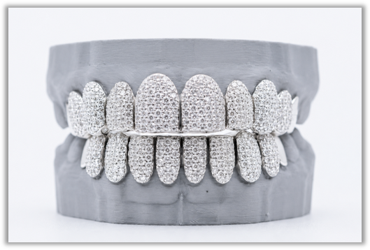 Full Bust Down VVS Moissanite Diamond White Grillz