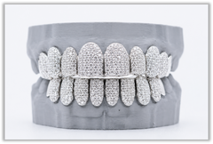 Full Bust Down VVS Moissanite Diamond White Grillz