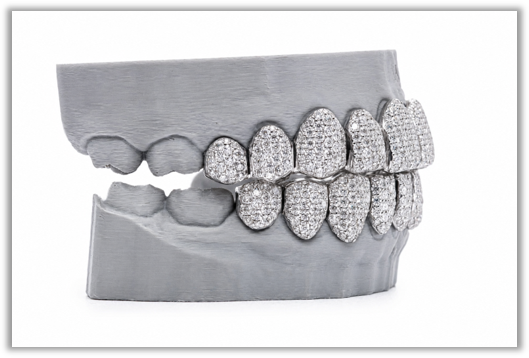 Full Bust Down VVS Moissanite Diamond White Grillz