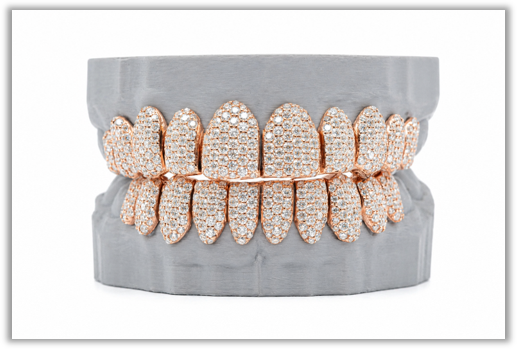 Full Bust Down VVS Moissanite Diamond Rose Grillz