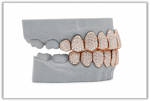 Full Bust Down VVS Moissanite Diamond Rose Grillz