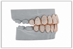 Full Bust Down VVS Moissanite Diamond Rose Grillz